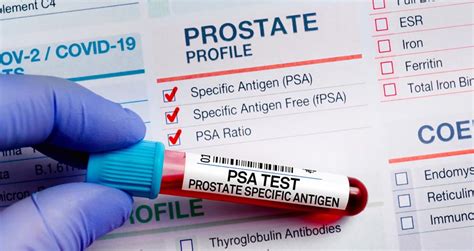 does alcohol affect psa test|Preparing For A PSA Blood Test .
